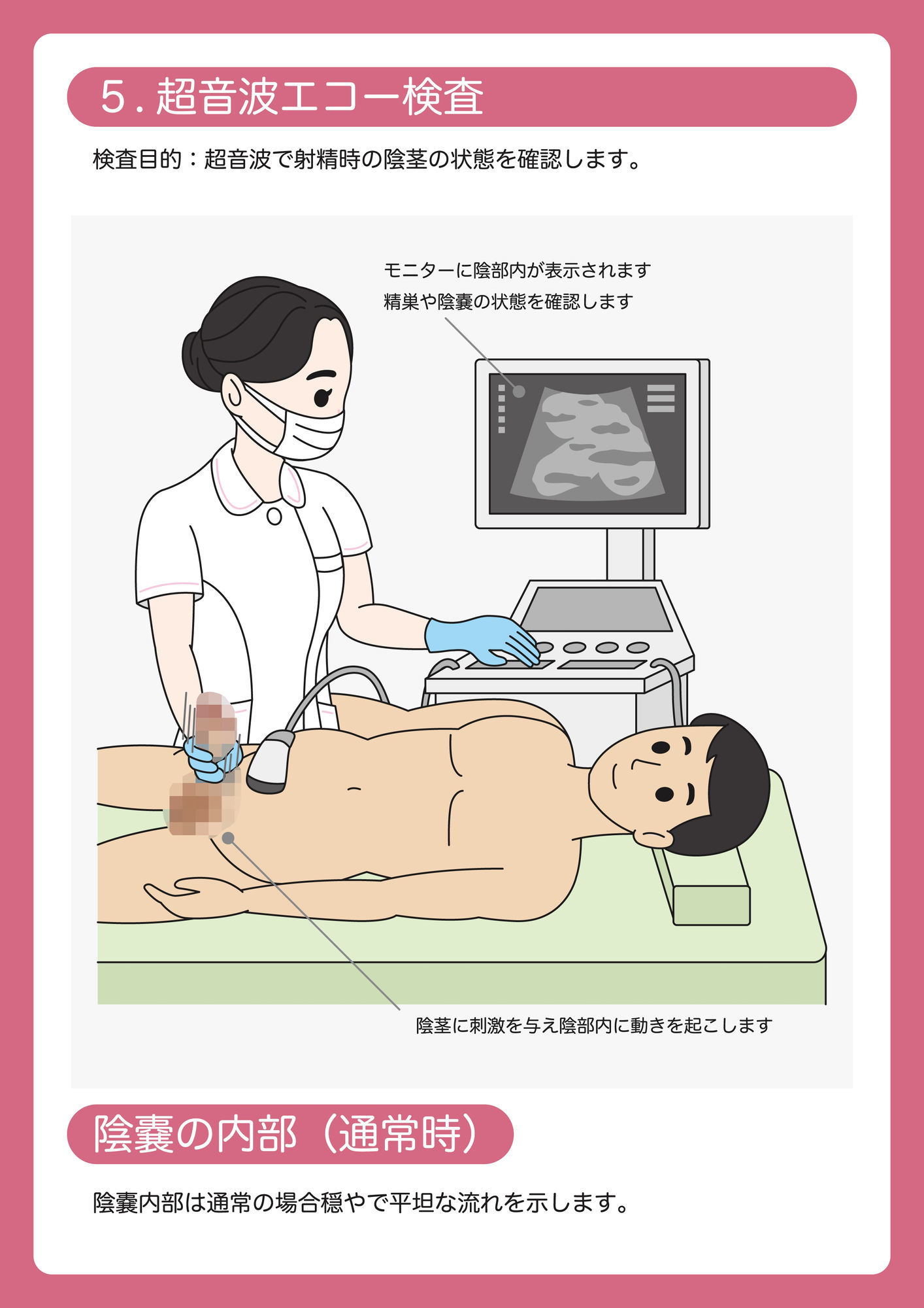 陰茎健診のご案内 - サンプル画像 6