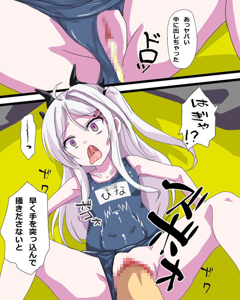 子宮脱アーカイブ - サンプル画像 3