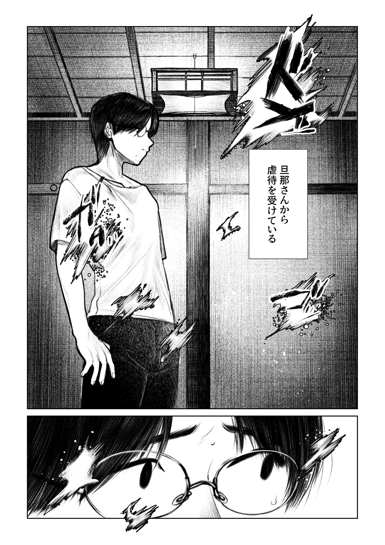 痣と痕 - サンプル画像 2