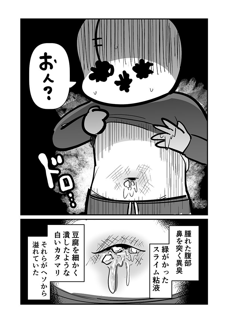 〆切に追われて栄養剤＋仮眠を繰り返していたらおヘソから膿が出て入院した話2 - サンプル画像 4